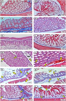 Influence of Prebiotic Activity of <mark class="highlighted">Agave</mark> salmiana Fructans on Mucus Production and Morphology Changes in Colonic Epithelium Cell of Healthy Wistar Rats